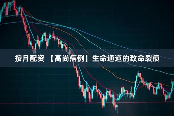 按月配资 【高尚病例】生命通道的致命裂痕